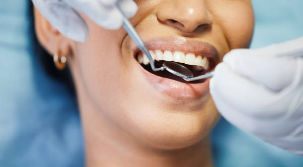 Best Emergency Treatment for Dental Infections or Abscesses in Land O Lakes, FL
